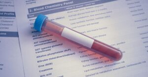 Blood Biomarker Testing: The Panel Worth Running Once a Year