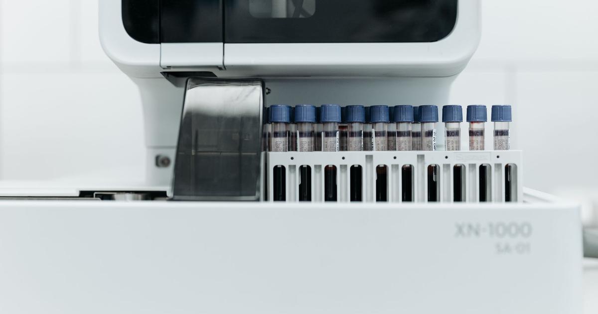 Rows of labeled blood sample test tubes in a rack at a medical testing lab, the kind of sample a biological age test starts from.